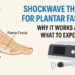 Plantar Fasciitis