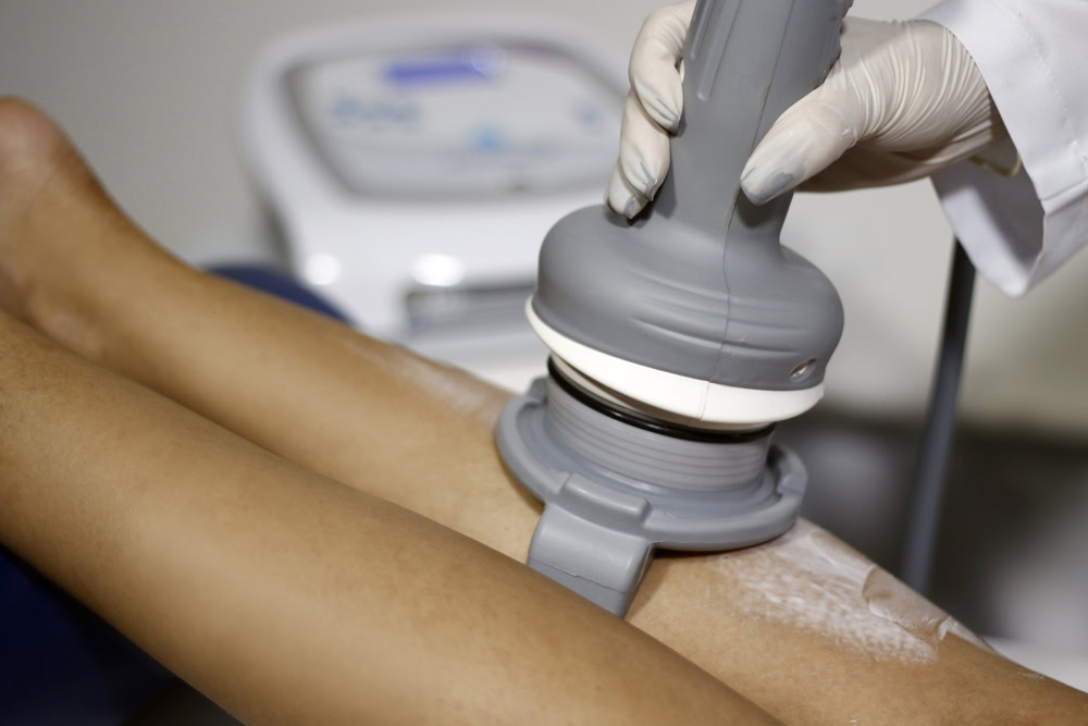 What to Expect During a Modellata Treatment Session